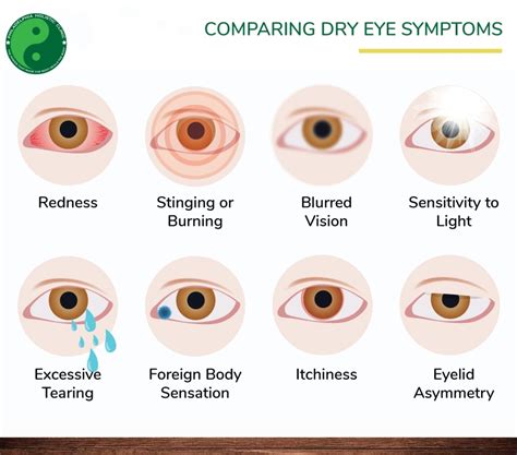 how to diagnose dry eyes